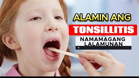 gamot para sa tonsil ng bata|Gamot sa namamagang tonsil .